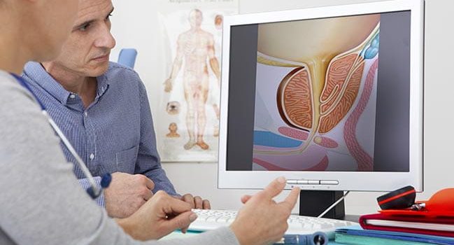 Key Factors That Influence Prostate Health Recommended by Experts
