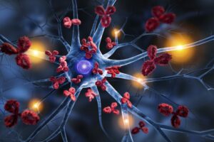 Autoimmune Diseases Explained: How Treatments Calm an Overactive Immune System