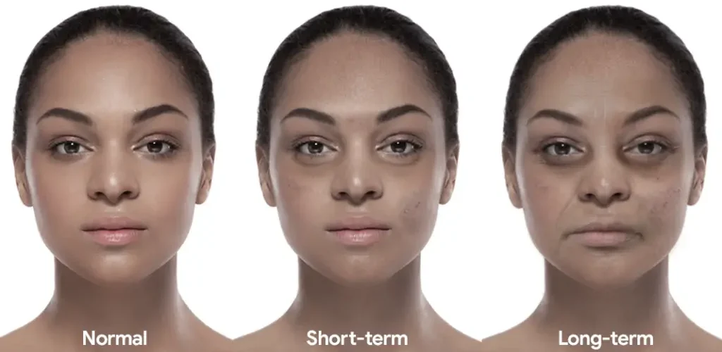 How Sleep Quality Reflects Directly on Your Skin Health