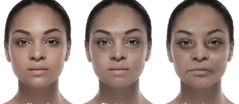 How Sleep Quality Reflects Directly on Your Skin Health