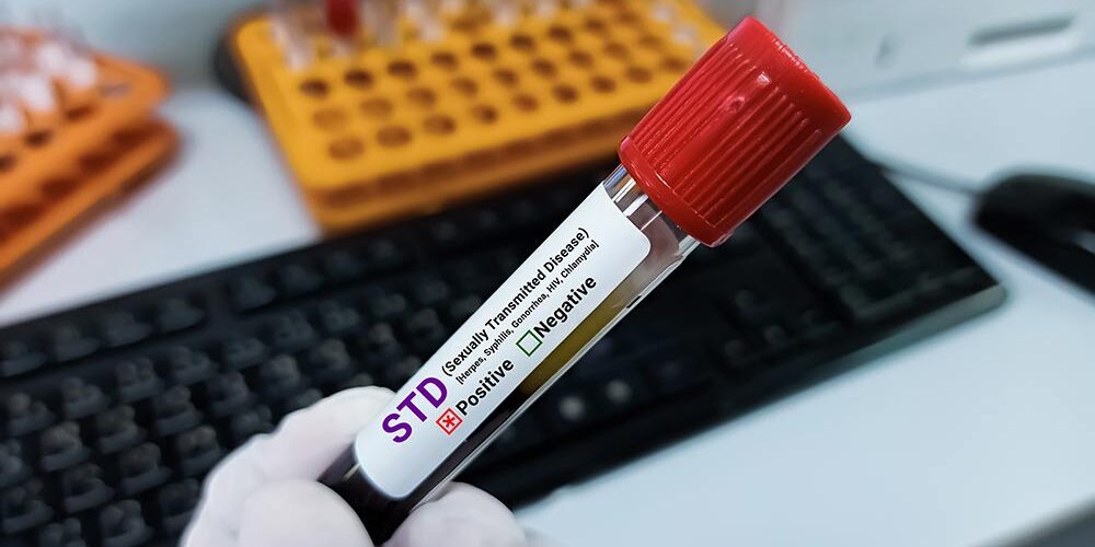 Confidential STD Testing in Patong: Same-Day Results for Tourists and Expats