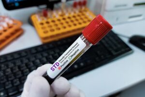 Confidential STD Testing in Patong: Same-Day Results for Tourists and Expats