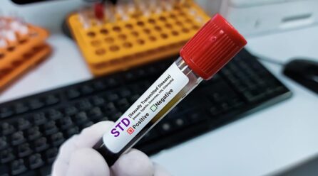 Confidential STD Testing in Patong: Same-Day Results for Tourists and Expats