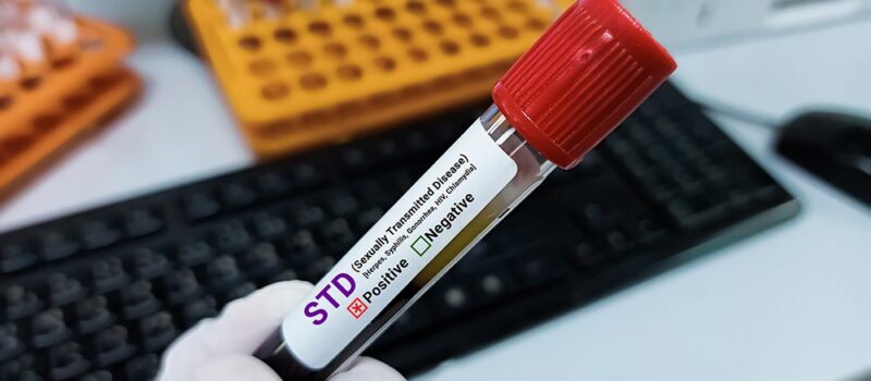Confidential STD Testing in Patong: Same-Day Results for Tourists and Expats