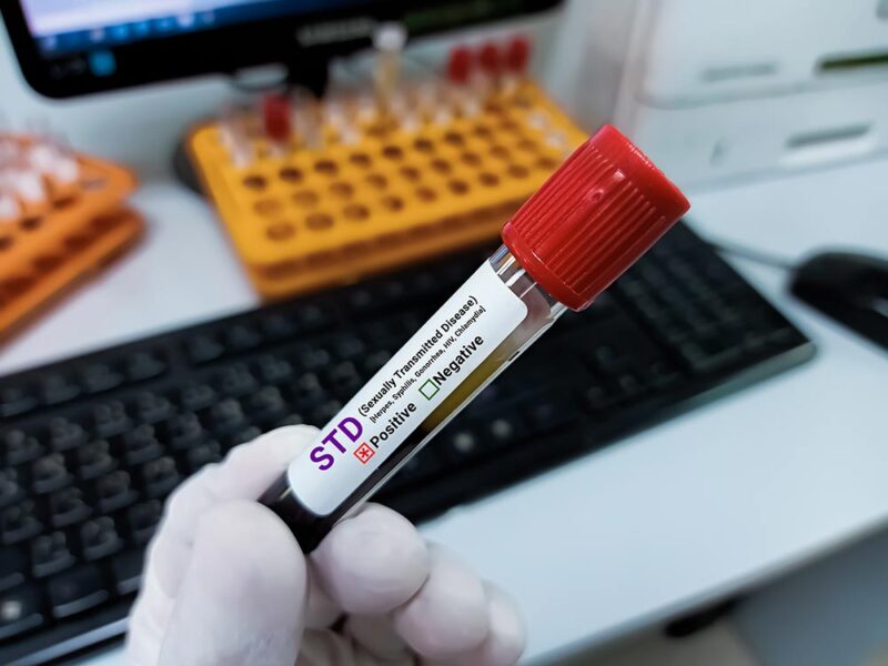 Confidential STD Testing in Patong: Same-Day Results for Tourists and Expats